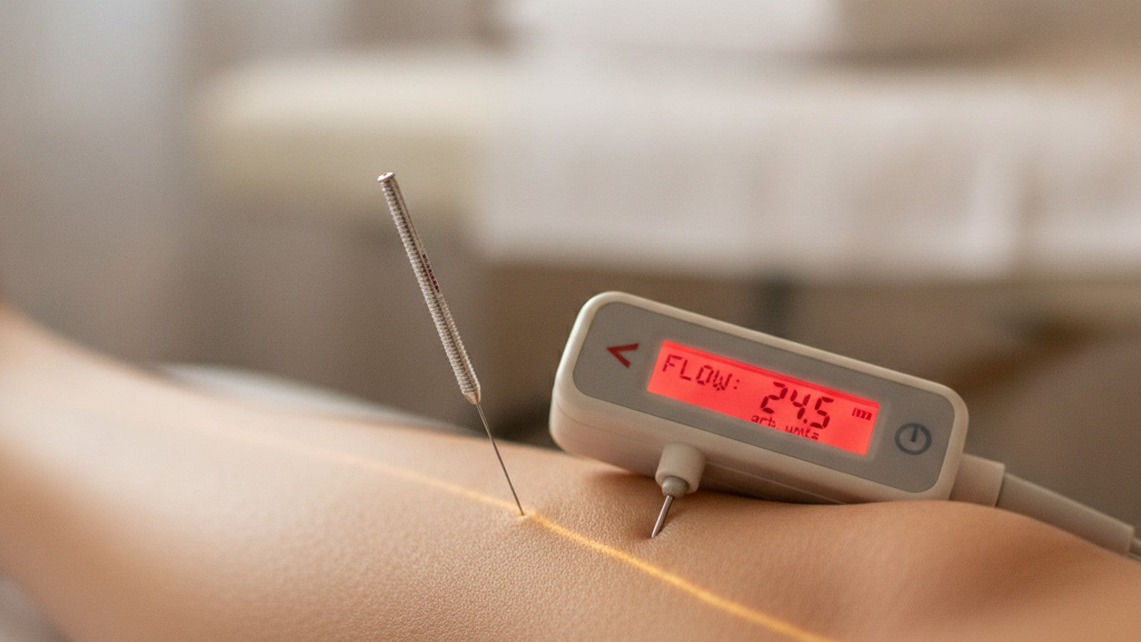 Acupuncture needle at ST36 point with microcirculation measurement device