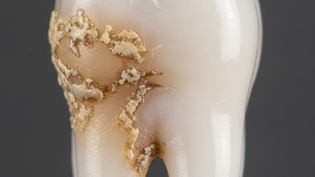 Close-up of tooth showing tartar buildup on one side and clean enamel on the other