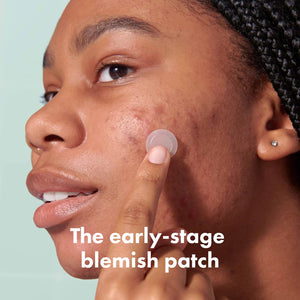 Hero Cosmetics - Mighty Patch Micropoint for Blemishes - 8 Patch(es) - The Oasis of Health