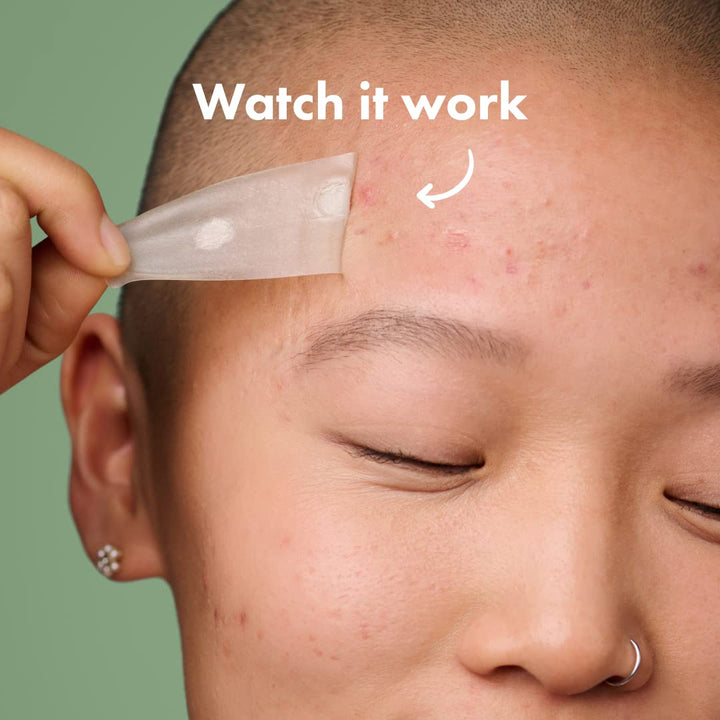 Hero Cosmetics - Mighty Patch Surface - 10 Strip(s) - The Oasis of Health