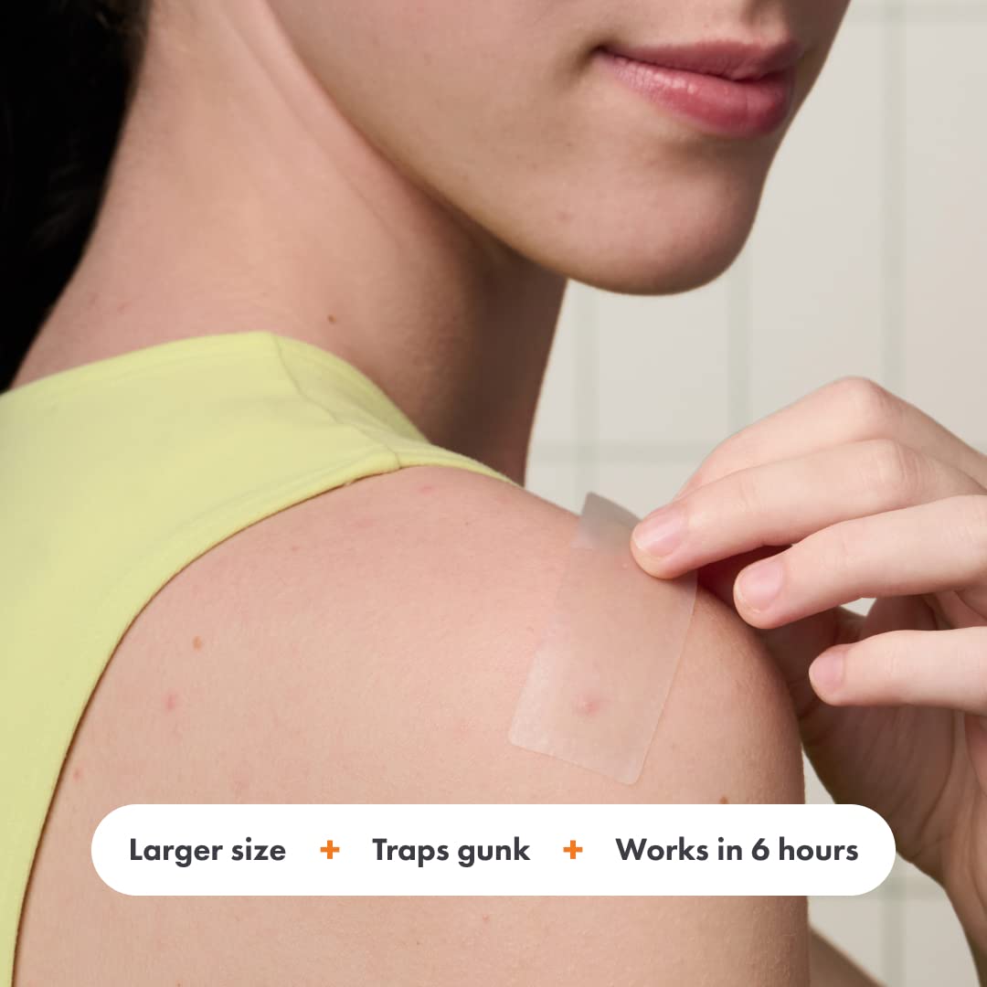 Hero Cosmetics - Mighty Patch Surface - 10 Strip(s) - The Oasis of Health